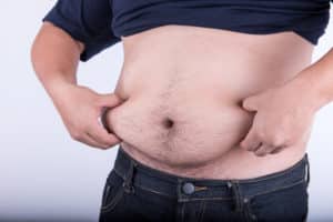 Scarless Office Monsplasty (liposuction & BodyTite) - Northern Virginia